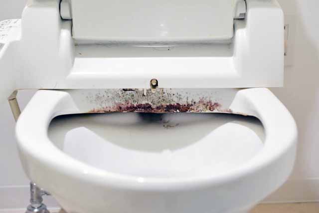 便器の汚れ画像